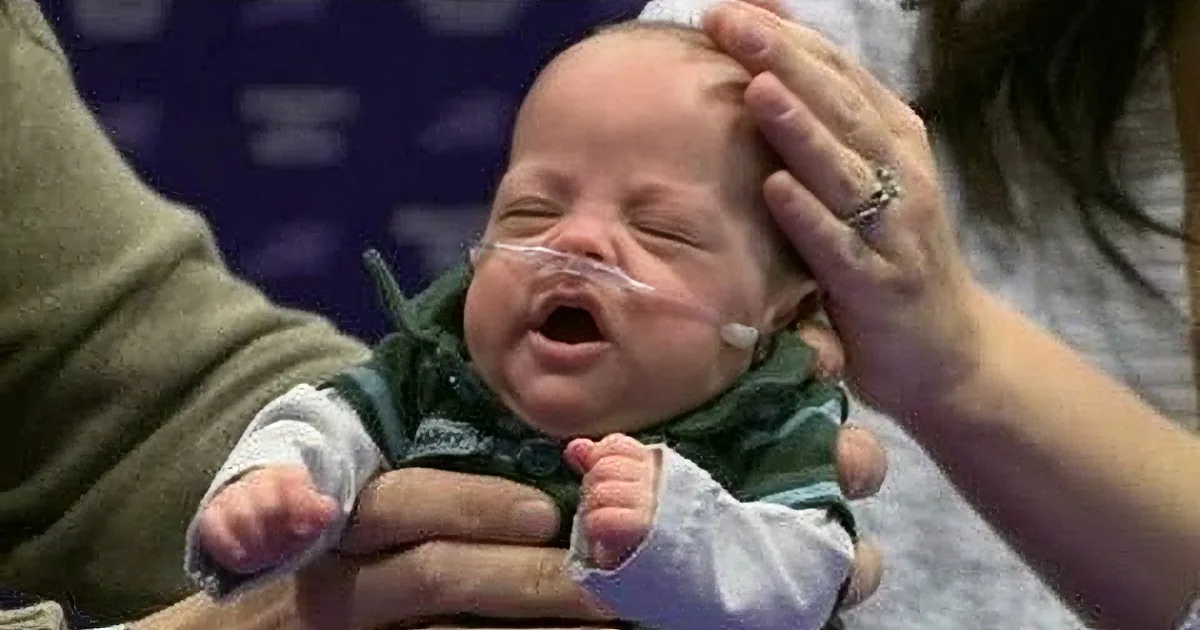 A newborn baby with a nasal cannula is being held, appearing to cry or yawn.