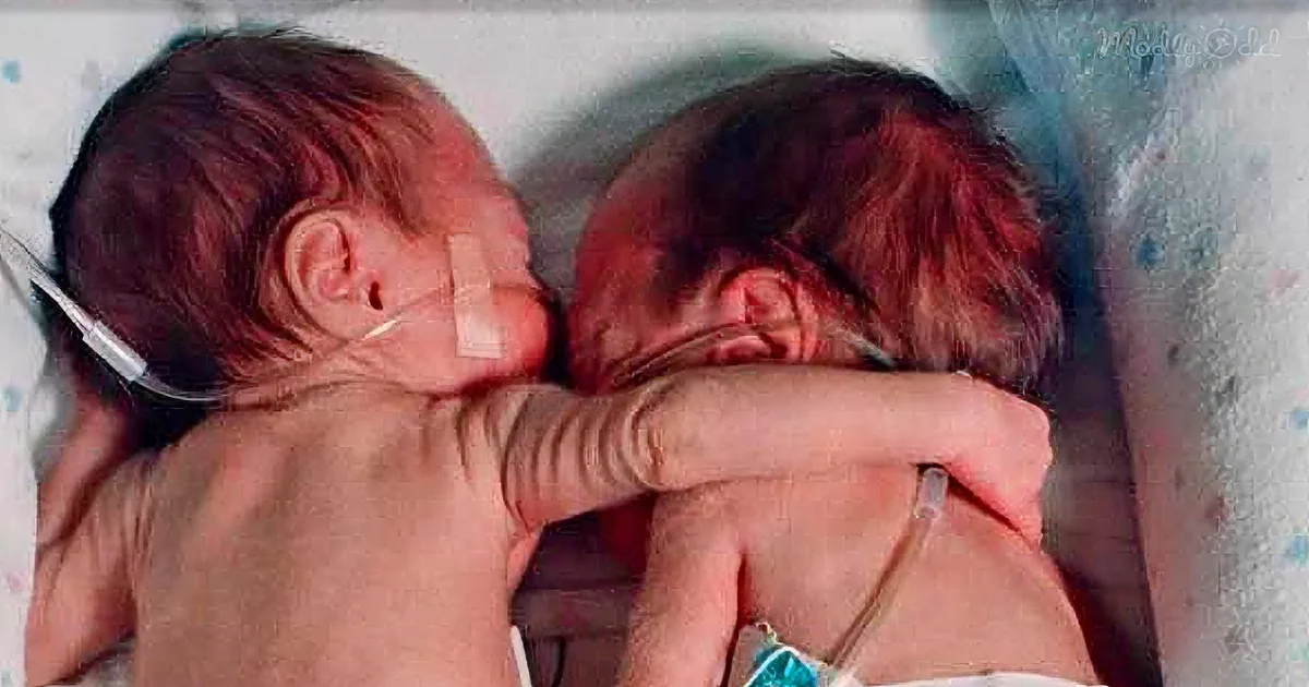 Nurse Puts Dying Baby Next to Her Twin, This ''Hug'' Results in a Miracle
