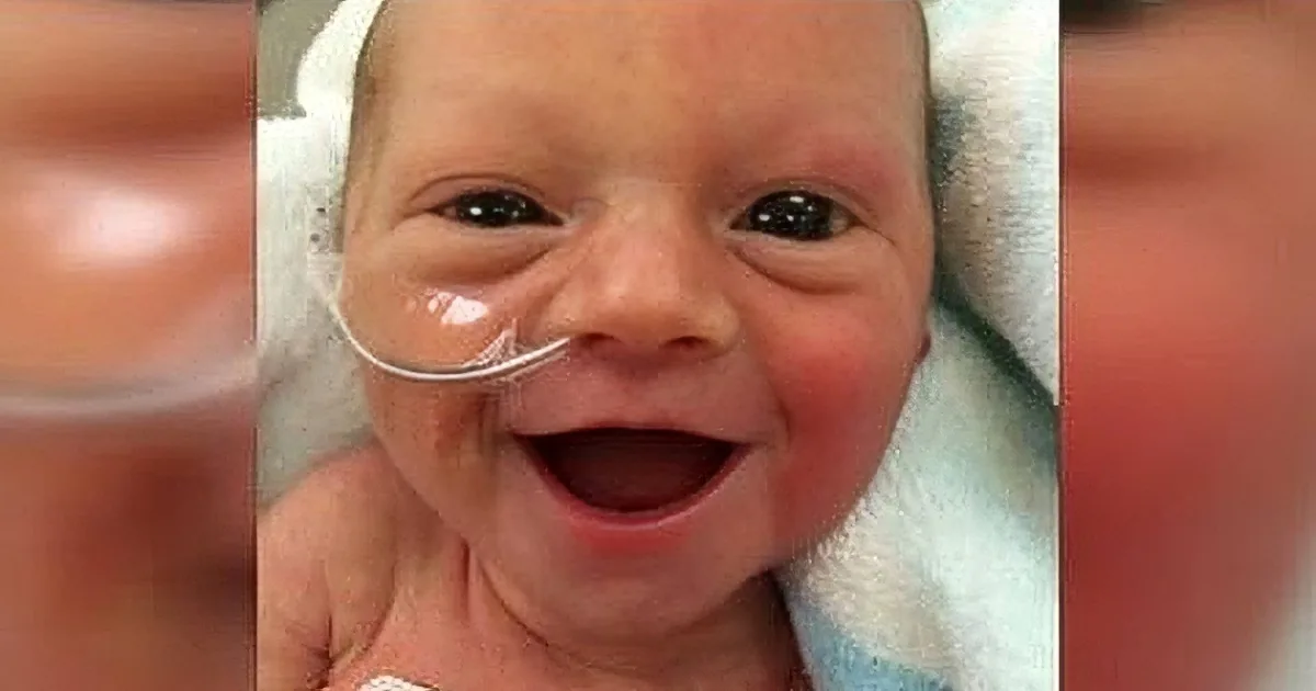 A newborn baby smiles widely, wearing an oxygen tube, wrapped in a white blanket.