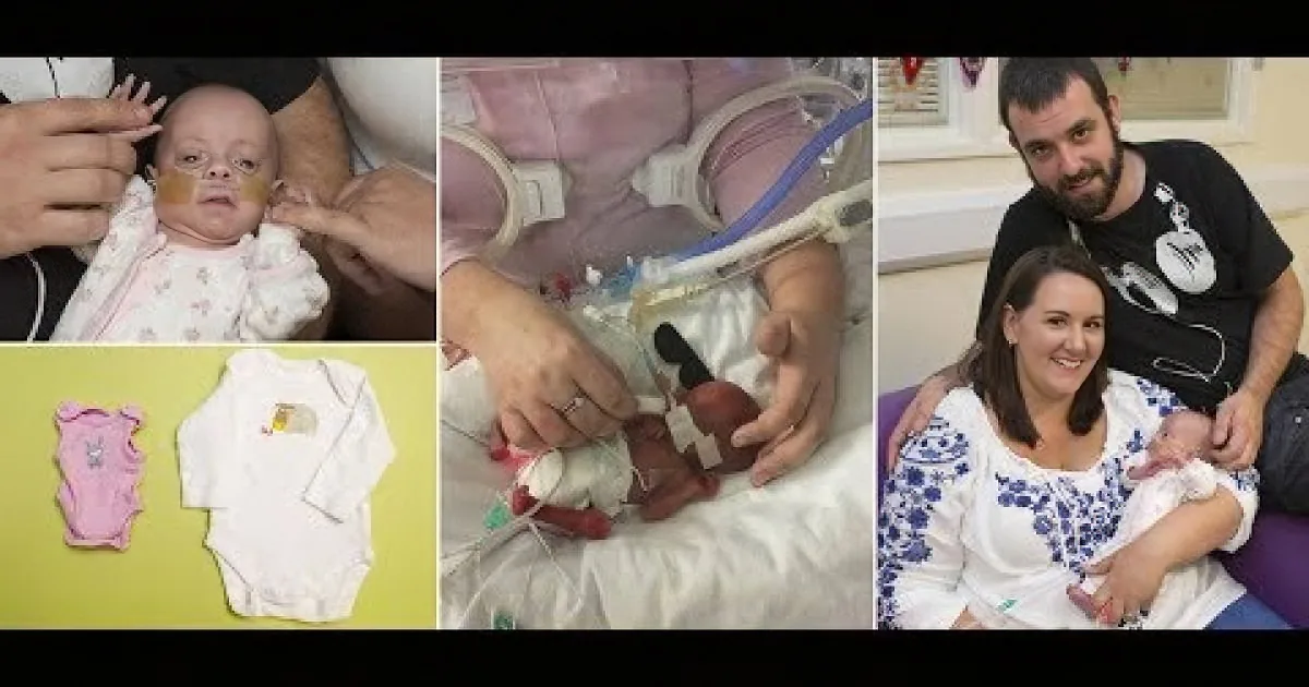 A collage shows a premature baby in various stages, from hospital care to family moments.