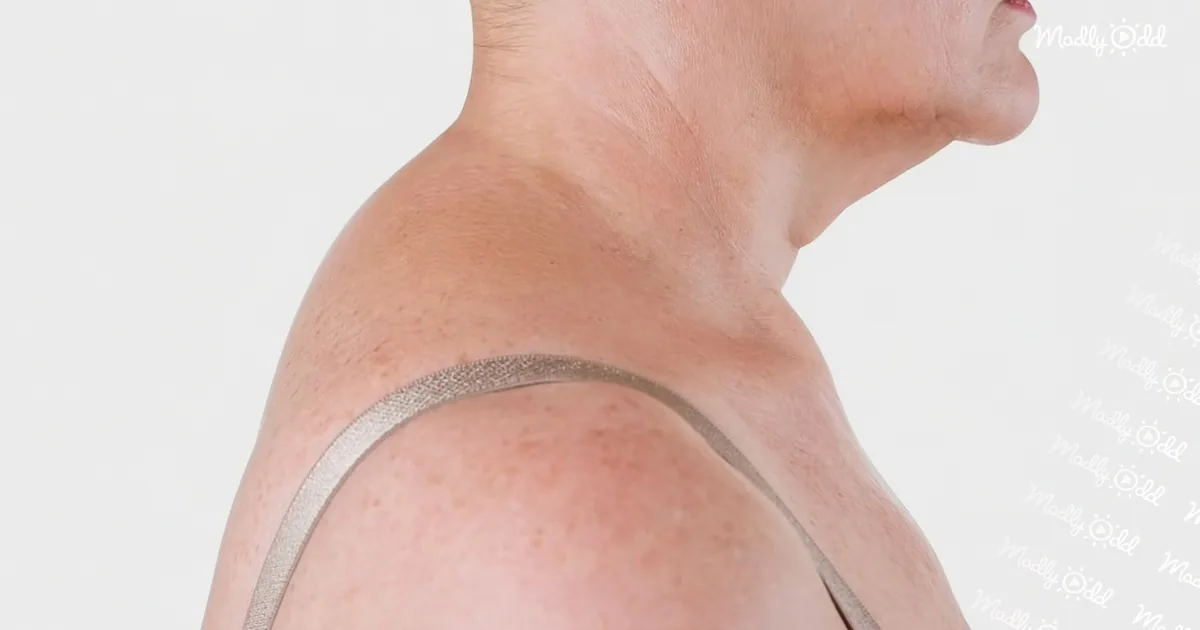 Fast Fix for ''Neck Hump''