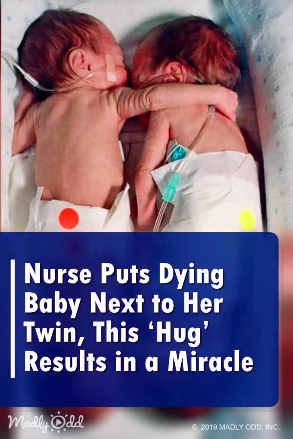 Nurse Puts Dying Baby Next to Her Twin, This ‘Hug’ Results in a Miracle