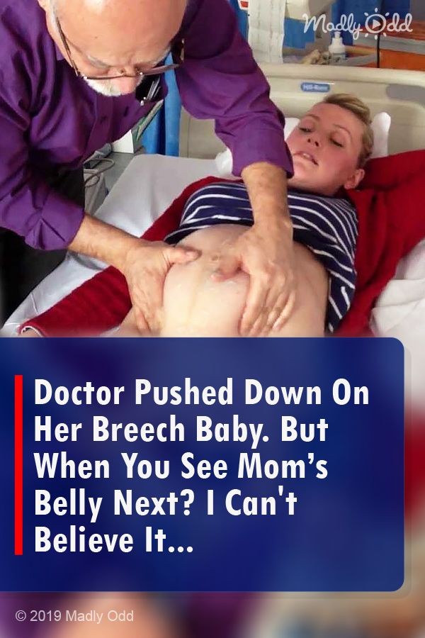 Doctor Pushed Down On Her Breech Baby. But When You See Mom’s Belly Next? I Can\'t Believe It...