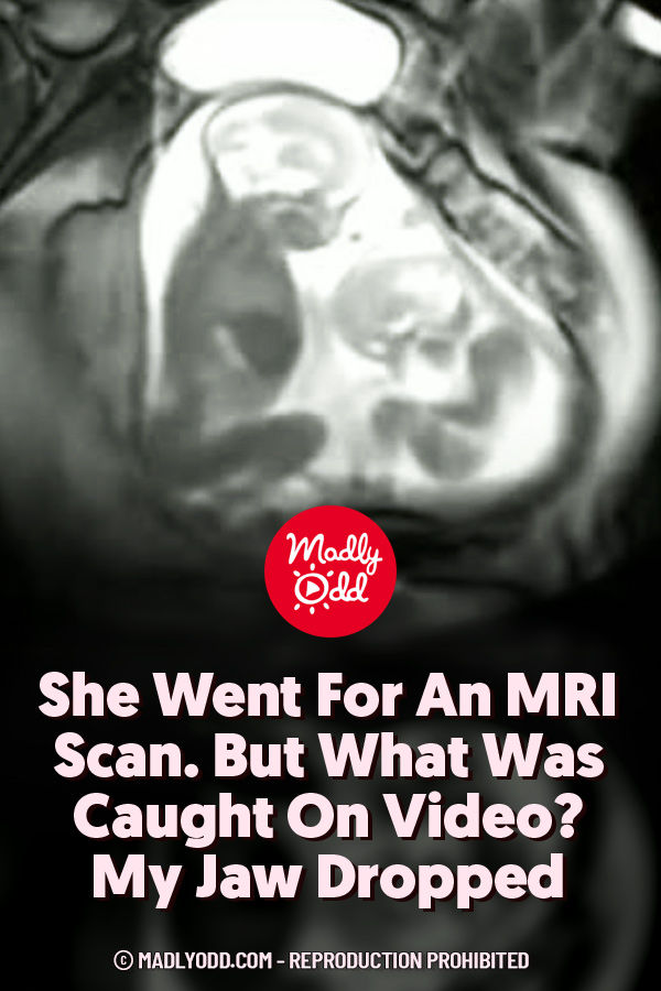 She Went For An MRI Scan. But What Was Caught On Video? My Jaw Dropped