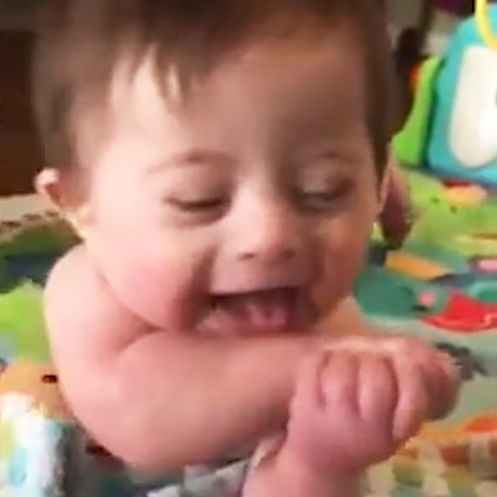 Baby with down syndrome